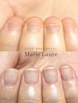 マリーロール 天王寺店(Marie Laure)/深爪矯正/自爪育成/ネイルケア