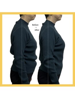 美容整体 レモン/姿勢矯正