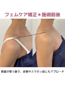 コルポ(CORPO)/フェムケア矯正で姿勢も綺麗に