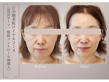 ベラ 東京院(Bella)/コツコツ重ねることが綺麗の近道