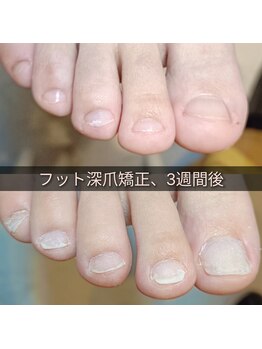 マニエネイル(mani e nail)/来年の夏には、美爪でサンダル♪
