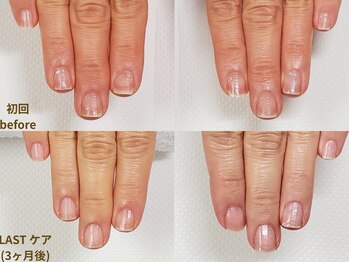 【地爪育成 症例2】