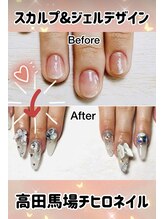 チヒロネイル/ギャル系スカルプビジューネイル