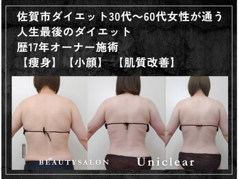 ユニクリア 佐賀(Uniclear)の写真/本気で見た目を変える!施術メインで美活痩身★むくみ・水太り・頑固な脂肪やセル凹凸・置き換えなし◎