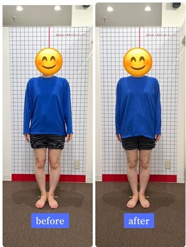 コアバランス整体院の写真/【1回で実感】諦めていたO脚・歪みを根本改善!写真で変わる美脚ライン、骨盤矯正で理想のスタイルへ★