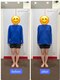 コアバランス整体院の写真/【1回で実感】諦めていたO脚・歪みを根本改善!写真で変わる美脚ライン、骨盤矯正で理想のスタイルへ★