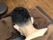 はり処せと
