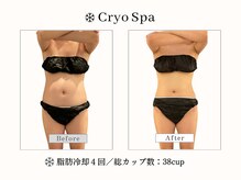 クリオスパ 豊春店(Cryo Spa)