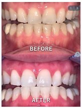 ライトビューティー 池袋店(LightBeauty)/症例写真