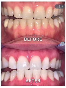 ライトビューティー 池袋店(LightBeauty)/症例写真