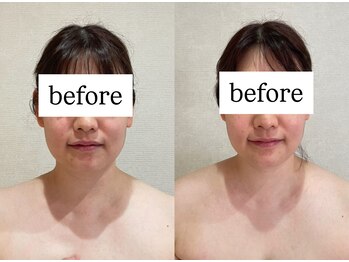 シェリーナ(cherieNa)/before→beforeが変わっていく