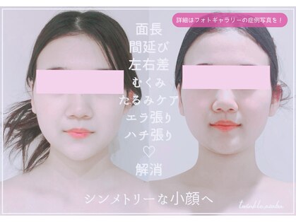 トゥインクル 麻布(twinkle)の写真