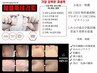 【抗酸化/弾力UP】MTSダーマ+アップルエクソソームセラピー¥28,800→¥15800