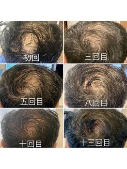 髪顔体/育毛促進結果！