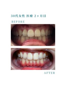 ミノリ(MINORI)/JR福間駅から徒歩5分