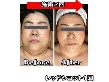 コンフィデンス 谷町四丁目店(Confidence)/