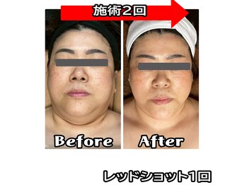 コンフィデンス 谷町四丁目店(Confidence)/