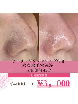 スムース イー(Smooth+E)の写真/【効果即実感】花粉肌荒れにも◎いちご鼻・黒ずみ・角栓すっきり！ざらつきなしツルツル肌にトーンアップ◎