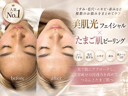 ティアラ 葛西店(TIARA)の写真