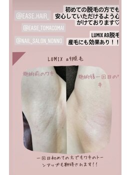 イースヘアーアンドビューティーショップ(ease hair&beauty shop)/美肌脱毛