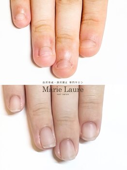 マリーロール 梅田店(Marie Laure)/自爪育成/深爪矯正/ネイルケア