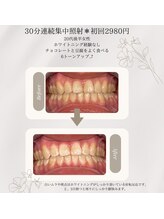 プラスビーセルフ(+b self)/ホワイトニングビフォーアフター