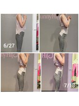 バニーヒップ(Bunny Hip)/before→after