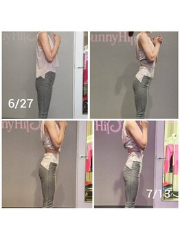 バニーヒップ(Bunny Hip)/before→after