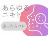 【ニキビ】今ある赤ニキビを集中ケア＋ホームケア付き