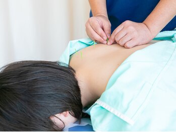 わかば鍼灸接骨院/体質に合わせた鍼灸