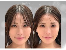 ソナ 大和西大寺院(SONA)/