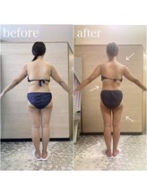 エステティックサロン アール 大阪梅田(esthetic salon R)/30代女性　後