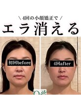 キュープ 鹿児島伊集院店(Qpu)/