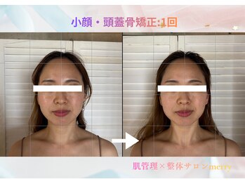 メリー 大和西大寺店(merry)/小顔・頭蓋骨矯正Before after★