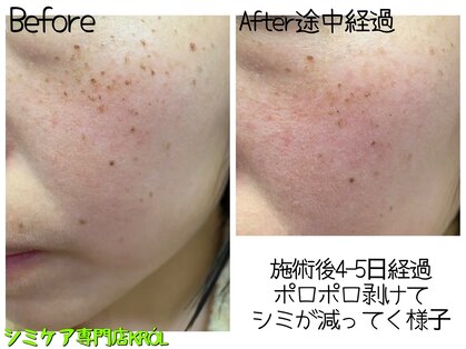 クルル(KROL)の写真
