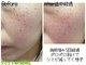 クルル(KROL)の写真