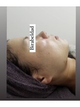 ビラ ベルダ(Bira Beldad)/