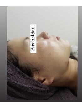 ビラ ベルダ(Bira Beldad)/