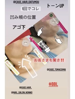 イースヘアーアンドビューティーショップ(ease hair&beauty shop)/話題BBL
