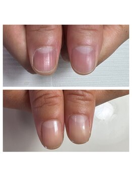 ケアで自爪育成コース