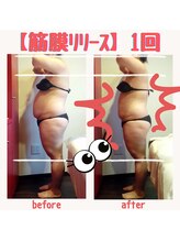 ビューティサロン キヨの部屋(beauty salon)/【筋膜リリース】 １回