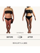 サンテボーテ(Sante Beaute)/全身集中ダイエットコース
