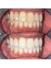 ライトビューティー 池袋店(LightBeauty)/症例写真