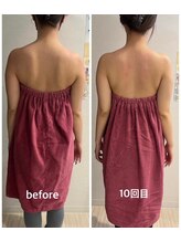 ロココ 表参道店(Rococo)/背中スッキリ