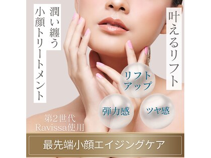 ミロワール ドゥ サピュイェ(MIROIR de Sappuyer)の写真