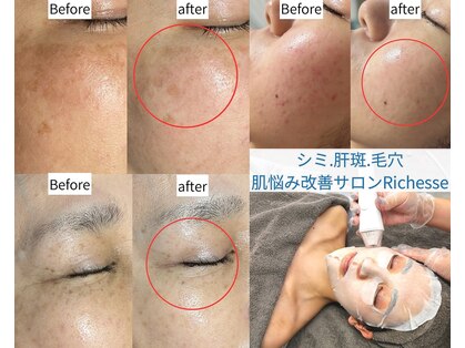 リシェス(Richesse)の写真