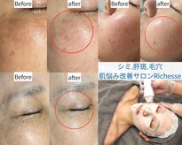 リシェス(Richesse)