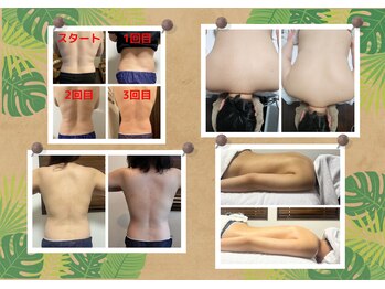 リラクゼーションサロンネロリ/お客様に合ったメニューで結果を