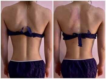 イーリバイブ/iNVYDOM MAX