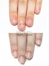 マリーロール 梅田店(Marie Laure)/自爪育成/深爪矯正/ネイルケア